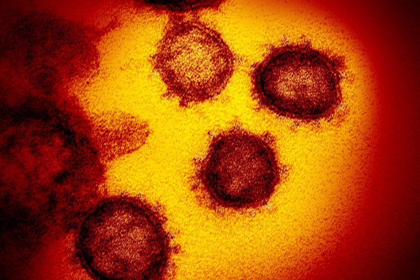 coronavirus al microscopio elettronico