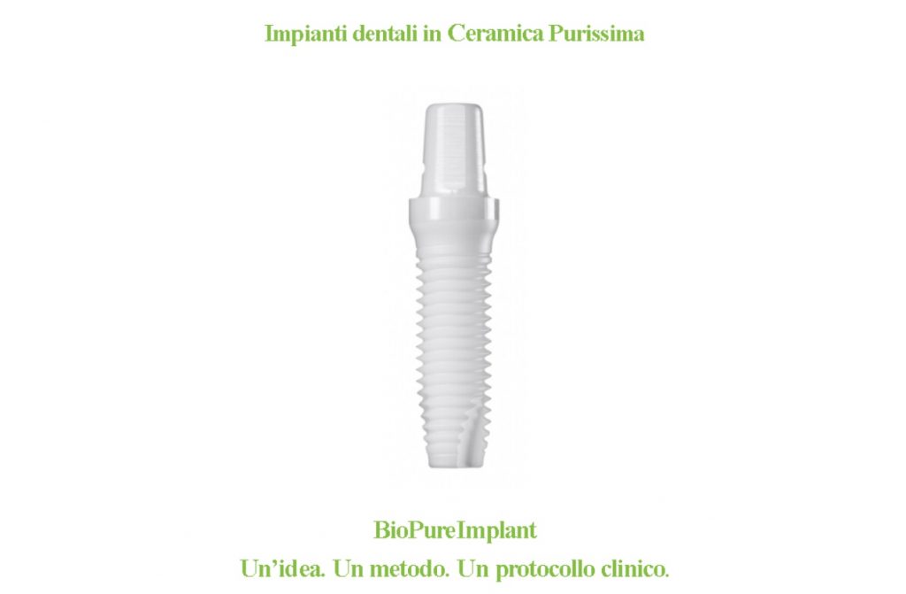 Impianti dentali in ceramica purissima