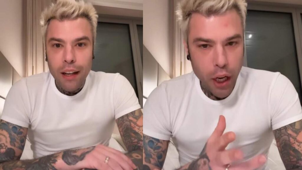 Fedez spiega i motivi della balbuzie in diretta Instagram