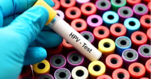 Hpv Provetta virus