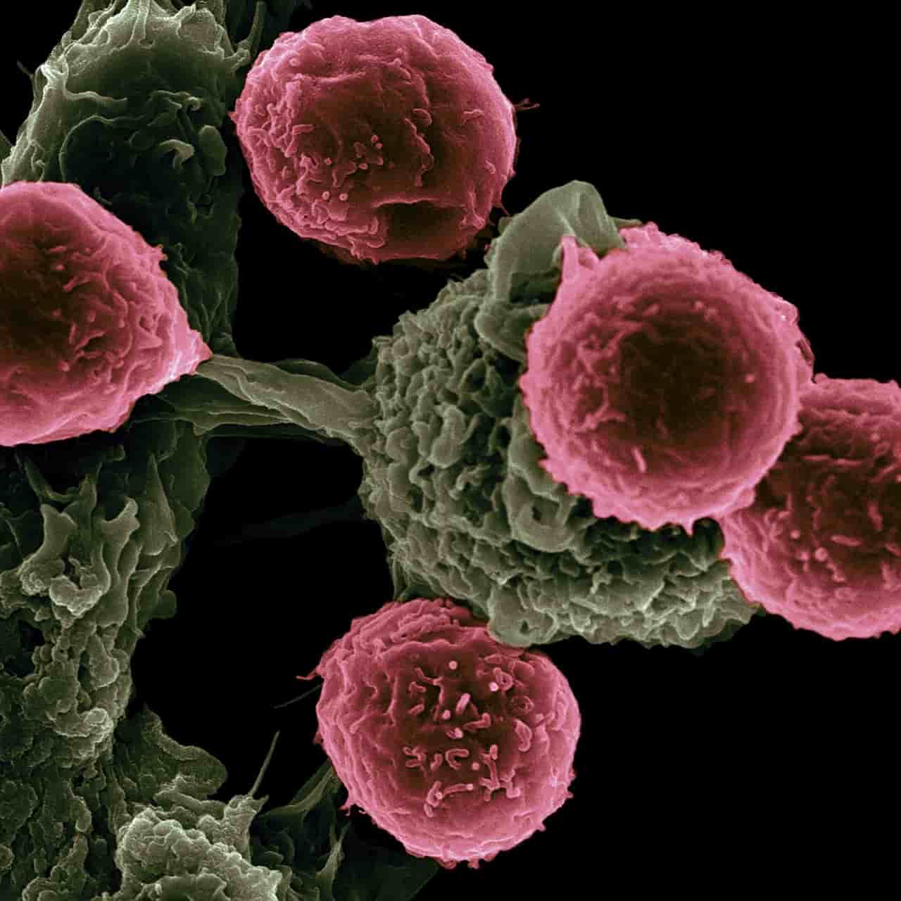 Cancro, Cellule tumorali