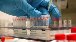 Analisi del sangue, Gwada negativo