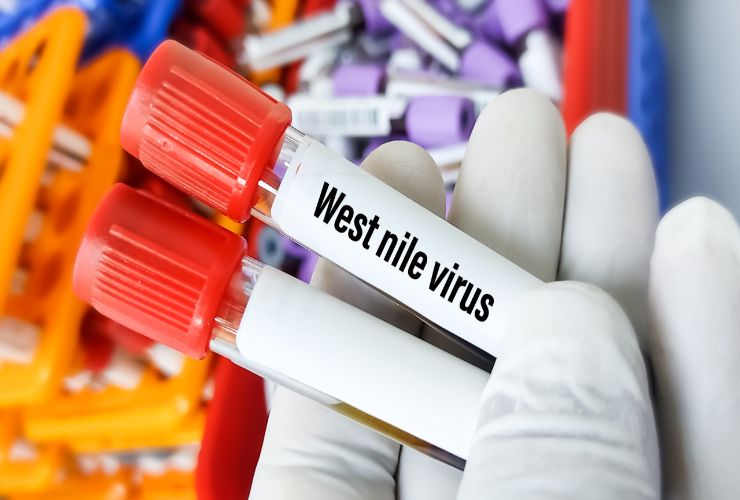 Virus West Nile