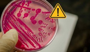 Salmonella