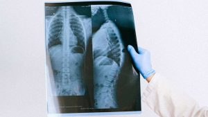 Raggi, radiologo, pexels shvetsa